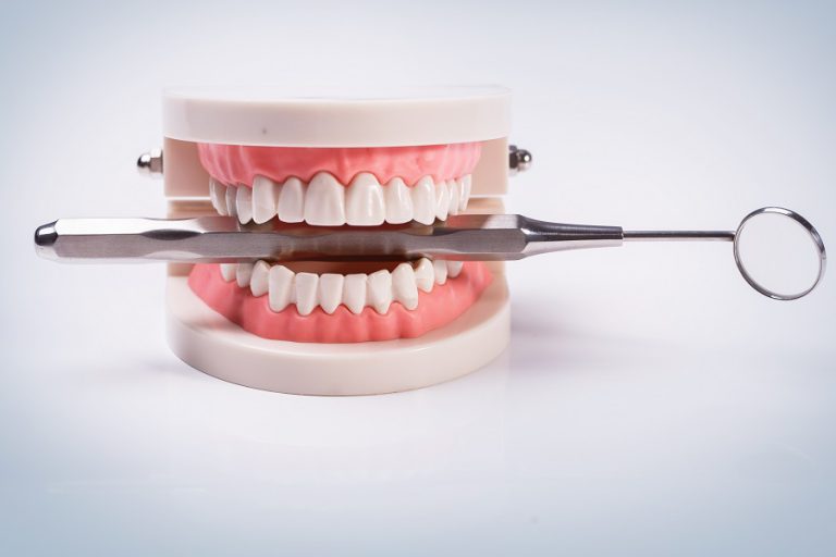 ما هي استخدامات (الجبس في طب الاسنان)؟